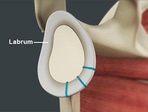 Shoulder Stabilization